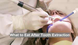 What to Eat After Tooth Extraction